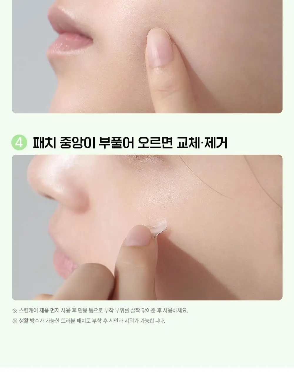 [초슬림] 파티온 노스카나인 트러블케어 스팟패치 102매 상세페이지 23
